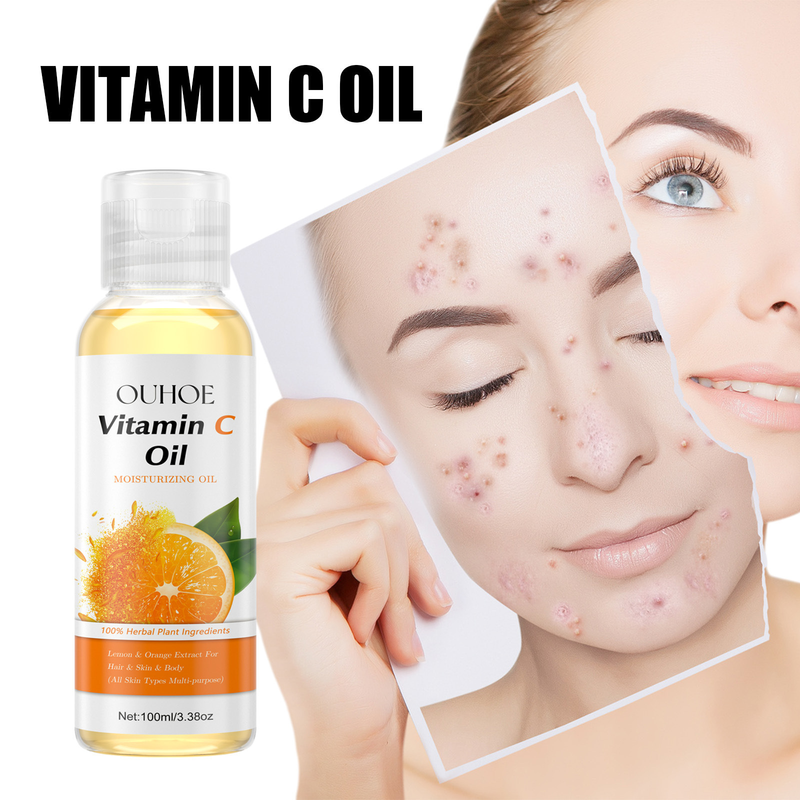 L'olio essenziale di vitamina C OUHOE idrata e illumina la pelle, resiste alle rughe, rassoda, ripara e nutre il cuoio capelluto_voghion.com