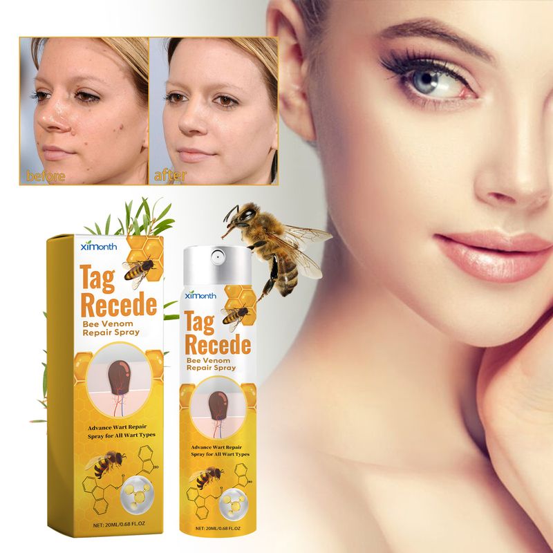 Ximonth Beesvenom tüükade hooldussprei, parandab nahaosakeste ja muttide parandamist, sileda naha tüükade ravisprei_voghion.com