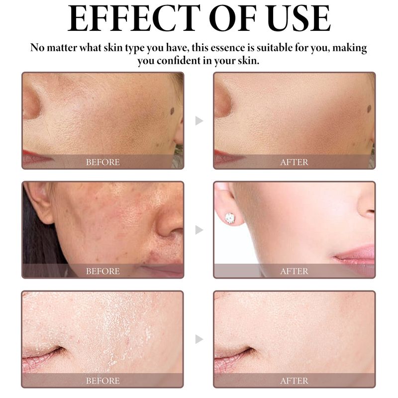 OceanAura Series Moisturizing Repairing Essence Liquid Erfrischendes, feuchtigkeitsspendendes, straffendes und aufhellendes Nicotinamid_voghion.com