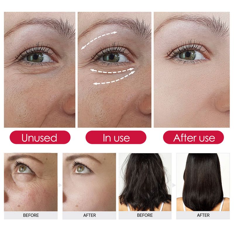 Rožu augļu sejas mitrināšana, ādas kopšana, mīkstināšana, matu masāža ēteriskā eļļa_voghion.com