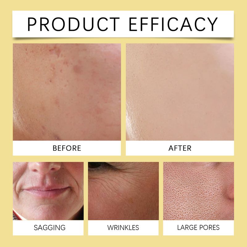 HOYGI Niacinamide Deep Hydrating Mask Feuchtigkeitsspendende und straffende, sanfte Pflege für weiche Haut_voghion.com