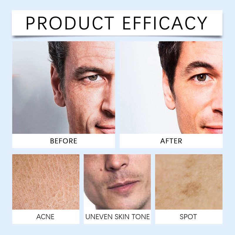 East Moon Men's sanft botzt d'Gesiichtshaut, erfrëschend Feuchtigkeitsscrub a kontrolléiert d'Uelegpeeling_voghion.com