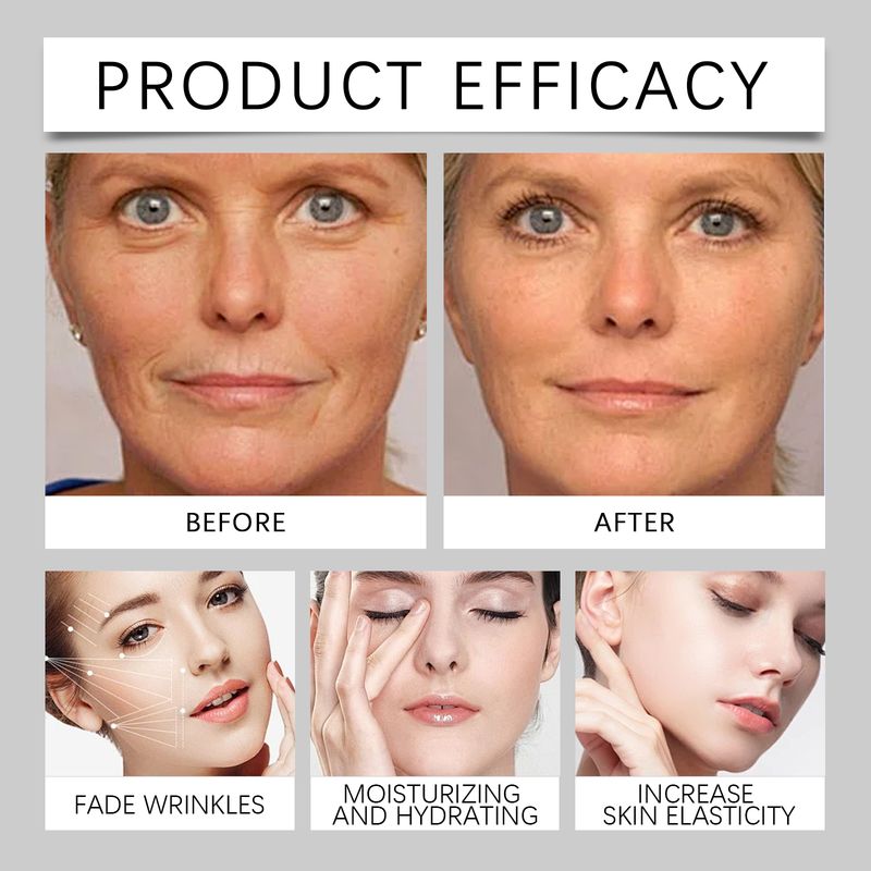 Wiyun Hyaluronic Acid Moisturizing Moisturizer, Improves Skin Elasticity And Moisturizes Skin Daily Care Cream_voghion.com