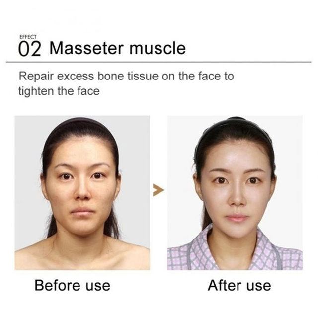 Crema eficaz para levantar la cara en forma de V, elimina la papada, adelgazante, crema de masaje de contorno firme, quema grasa facial, belleza antienvejecimiento para la piel_voghion.com