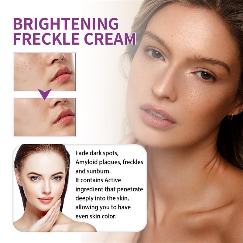 Nikotinamid Hvidningscreme til fjernelse af fregner Fjerner effektivt melasma Mørke pletter Aknemærker Lysner melanin Ansigtshudpleje_voghion.com