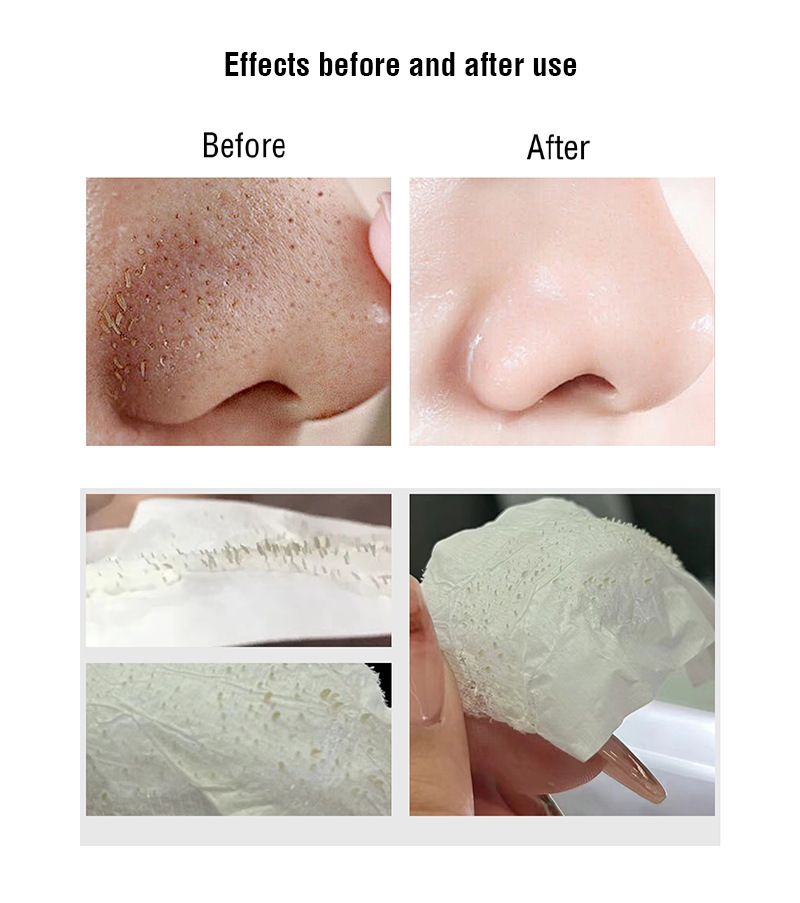 Oukeya Mitesserentferner-Peel-Off-Maske – Tiefenreinigende Porenstreifen für Nase und T-Zone, verkleinern Poren und verhindern Ausbrüche_voghion.com