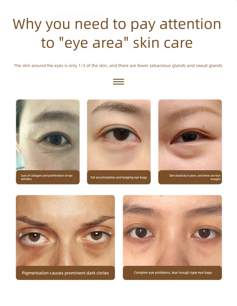 Beauty Instrument With Massage, Vibration, Heating, Red And Blue Light, The, Fine Line Care, Eye Protection Heat_voghion.com
