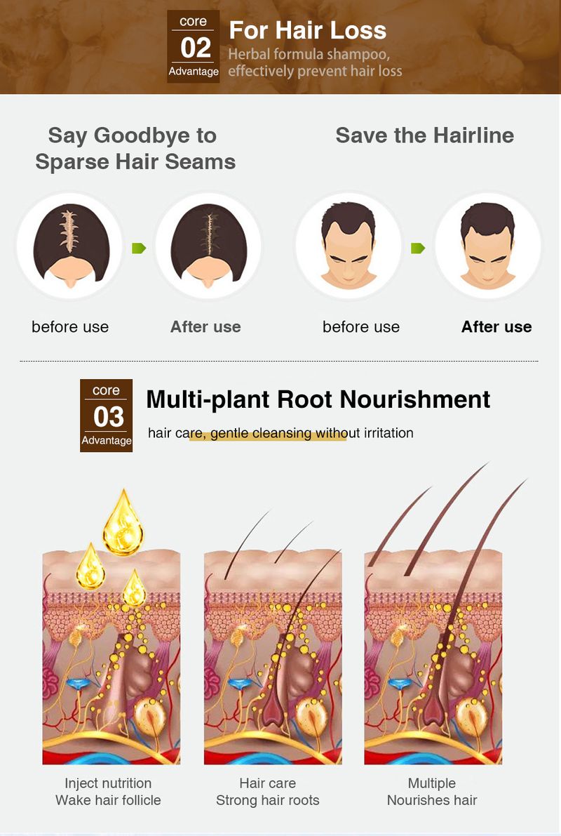 Kexun Firstsun Ingwer Erfrischendes, geschmeidiges, pflegendes Shampoo gegen Haarausfall_voghion.com