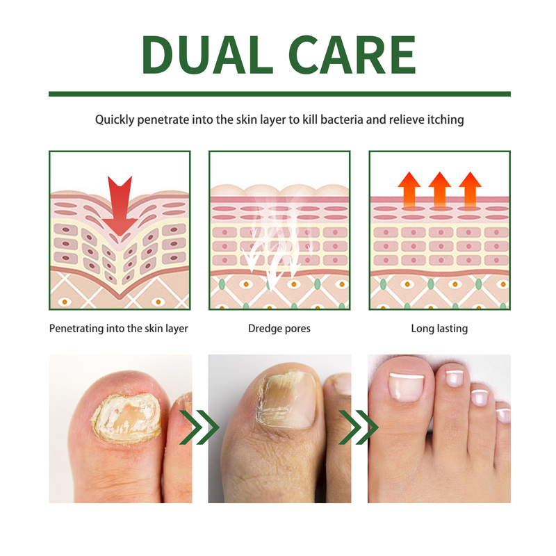 Máscara para os pés Moon South para reparação de unhas Máscara para os pés para reparação de unhas Unhas grisalhas Unhas brilhantes Pés secos e rachados Removendo pele morta_voghion.com