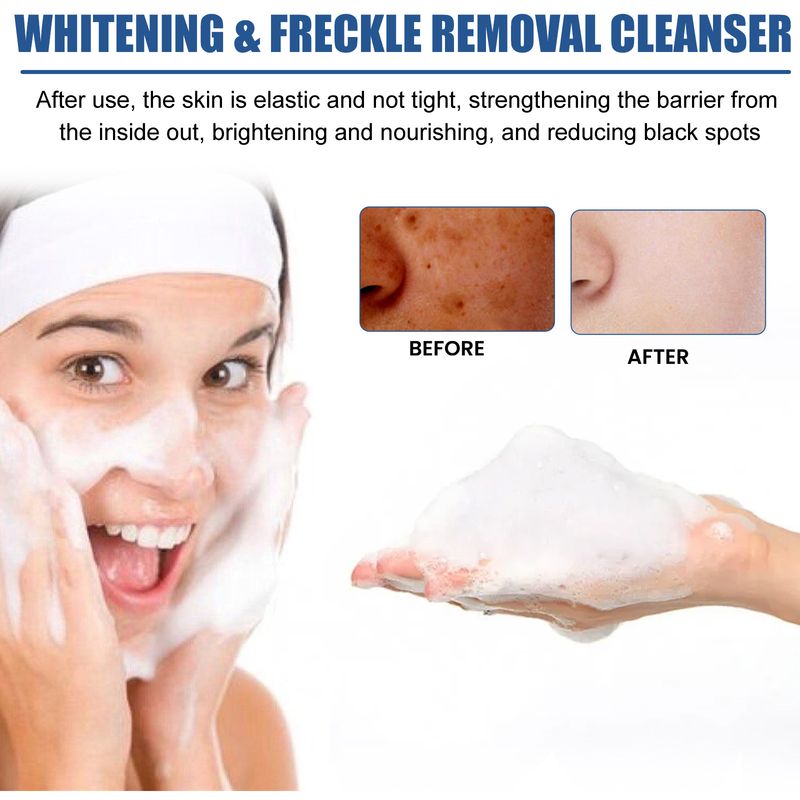 EELHOE Brightening Whitening Spot Milk for Oil Control, Deep Cleansing Pores, Desalination of Spots Acne Marks, and_voghion.com