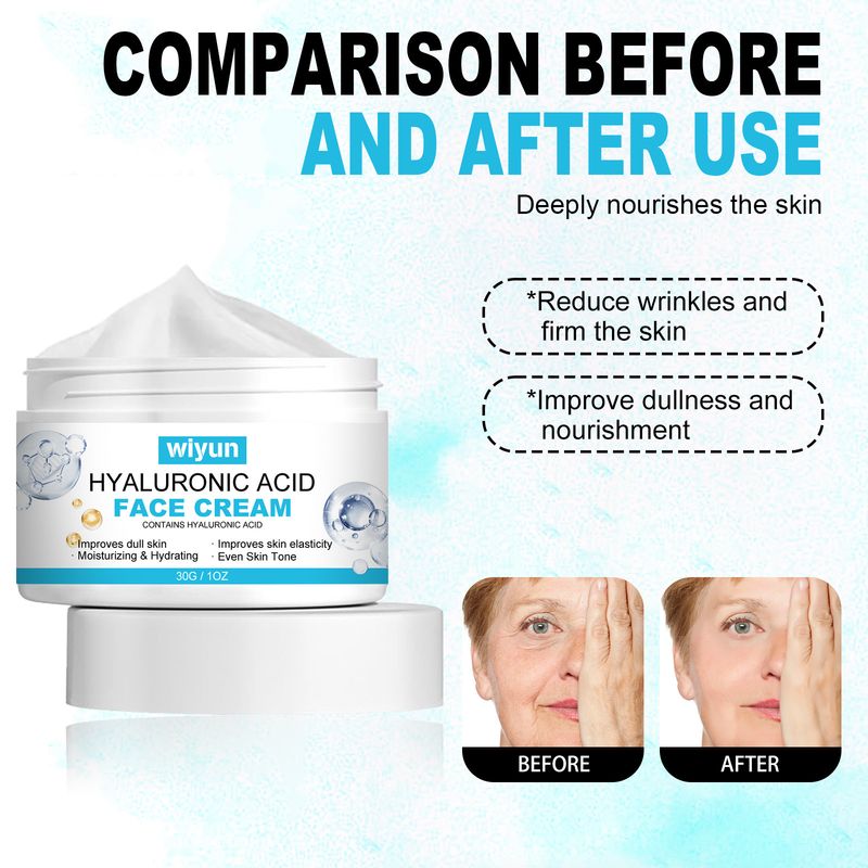 Krem z kwasem hialuronowym, nawilżający skórę, nawilżający i odżywczy_voghion.com