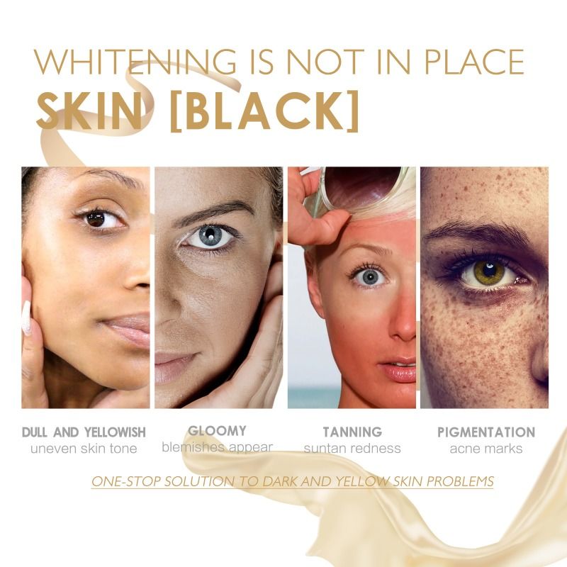 Siero illuminante correttore per macchie scure Rimuove le macchie scure sulla pelle Siero schiarente Spray idratante nutriente e illuminante per il viso_voghion.com