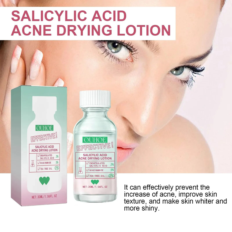 Salicylic Acid Acne Removal Serum Pimples Treatment Anti Whiteheads Oil Control Shrinking Pores Moisturizing Cleansing Skin Care Face care_voghion.com