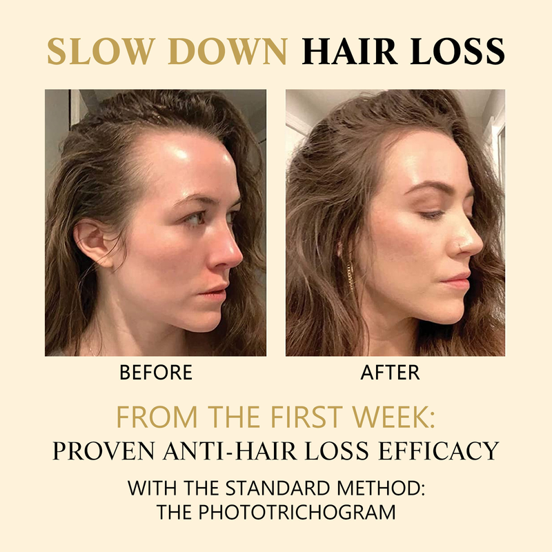 OUHOE ženšenni massaaž Niisutav peanahk, tugevad juuksed, pinguldav, väljalangemisvastane hooldus, tihe juukseessents_voghion.com