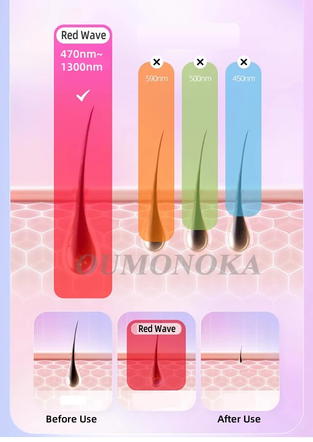 Blinkt Laser Epilierer Laser Vendita Calda Permanente IPL Photo Pilator Haaren Tfernung Schmerzlose Elektrische Epilierer Maschine_voghion.com