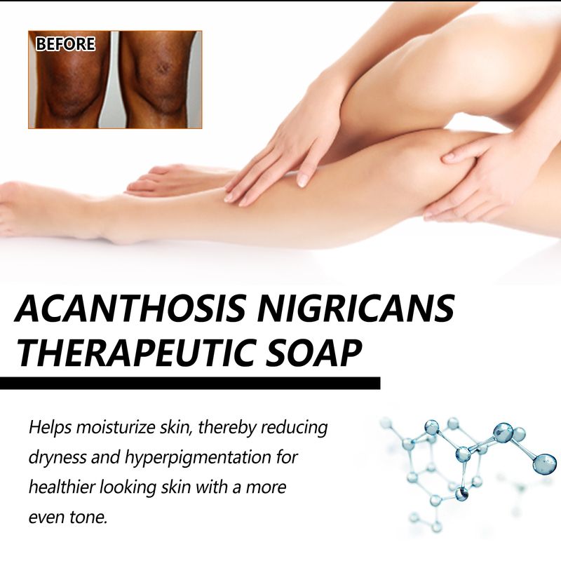 Ginocchio Gomito Ascella Corpo Clean Bar Idratare Sbiancare Acanthosis Nigricans Trattamento Carbone di Bambù Fatto a Mano_voghion.com