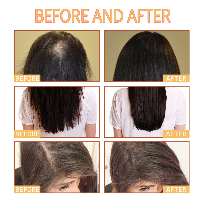 EELHOE Dense Hair Shampoo forhindrer hårtap, stabiliserer hår, beskytter tørt, ru og glatt hår_voghion.com