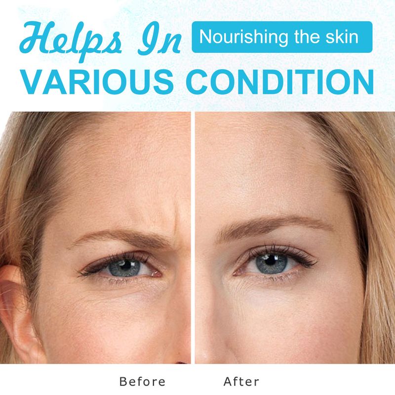 Krem z kwasem hialuronowym, nawilżający skórę, nawilżający i odżywczy_voghion.com