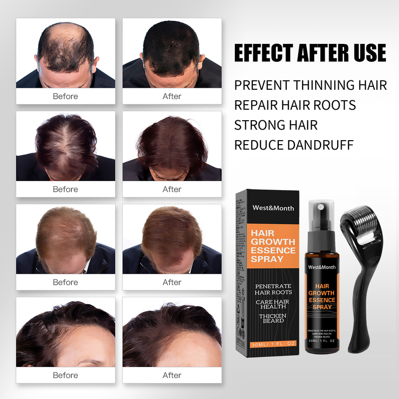 West&Month Polygonum multiflorum anti dropping hair Hair ginger spray thick hairline care solution_voghion.com