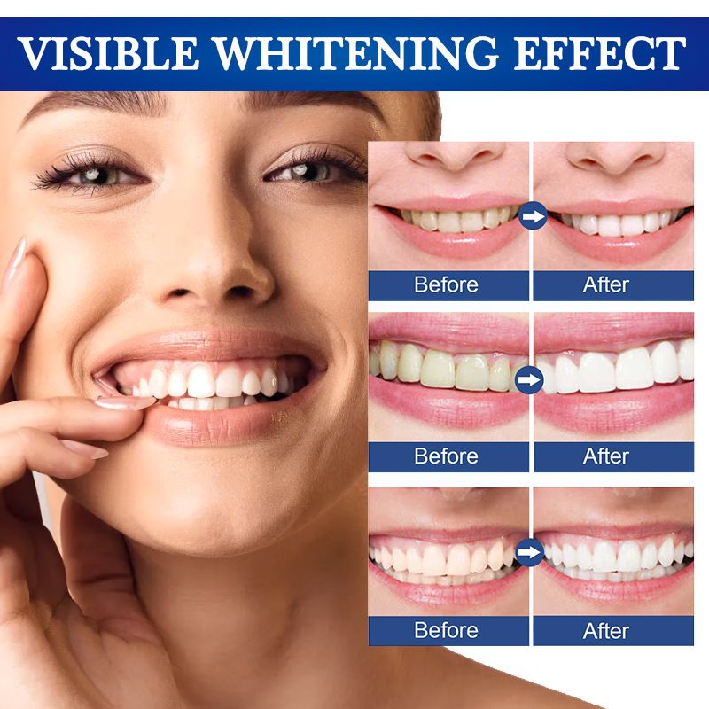Repair Yellow Brightening Gel Cleaning Stain Tooth Oral Care 2024_voghion.com