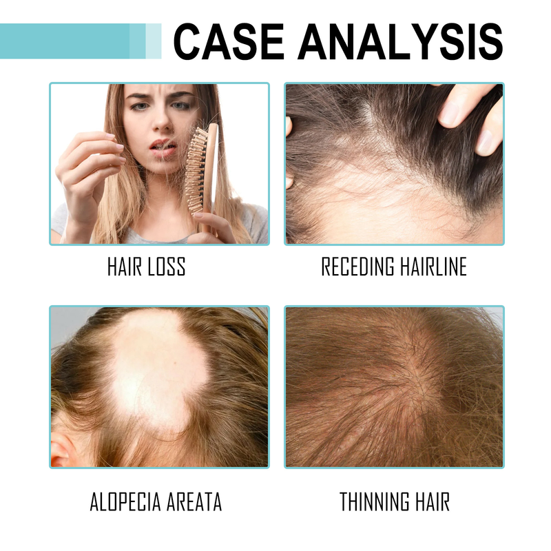 Hoegoa Dense Hair Essence Oil previene la caduta, ripara i capelli danneggiati, ammorbidisce e idrata i capelli_voghion.com