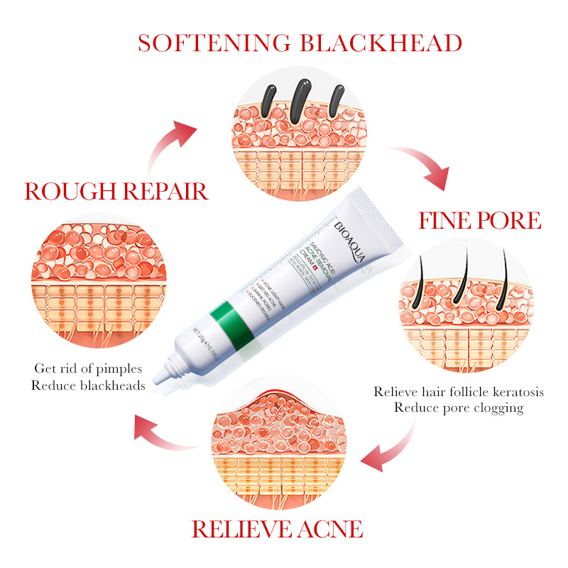BIOAOUA Salicylic Acid Hydrating Fading Marks Pore Minimizing Acne Treatment Cream_voghion.com