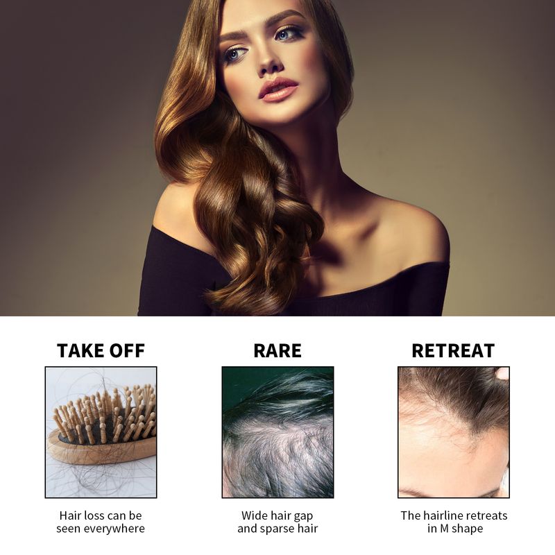 Loss Treatment Shampoo Anti-itch Anti Dandruff Control Hair Growth Serum Oil Scalp Root Thicker Fast Regrowth Essence_voghion.com