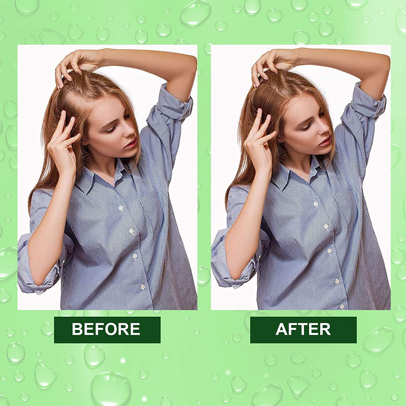 IBeaLee Her bal essence Oil Agente di crescita Nutrizione dei capelli Liquido_voghion.com