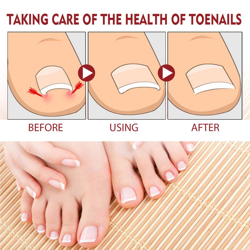 Jaysuing Anti Relieving Soft Brightening Repair Embedding Thickening Grey Nail Ditch Care Oil_voghion.com