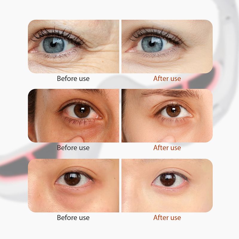 Masajeador de microcorriente EMS con luz roja para reducir las ojeras y la apariencia de los ojos (2025)_voghion.com