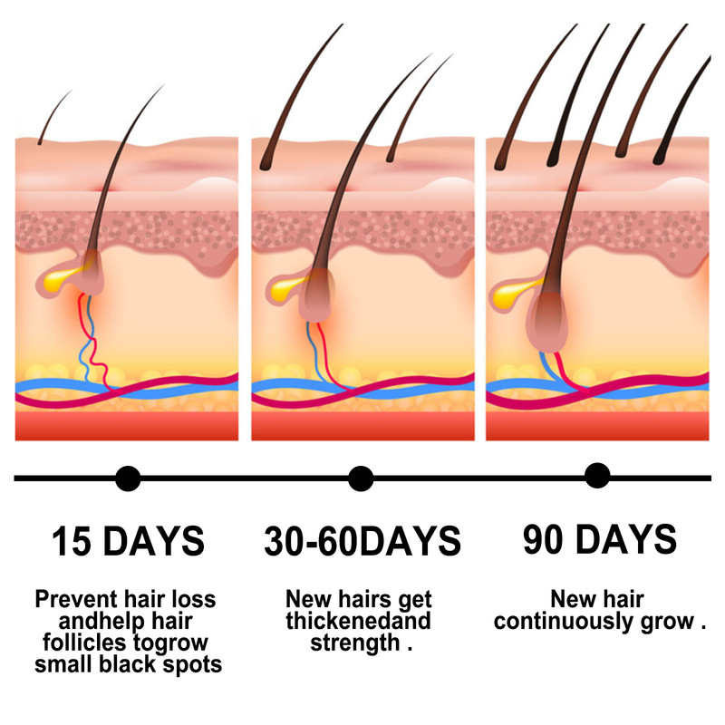 EELHOE Ginger Essential for Repairing Follicles, Smooth Moisturizing Growth, and Nourishing Hair Care Essence Oil_voghion.com