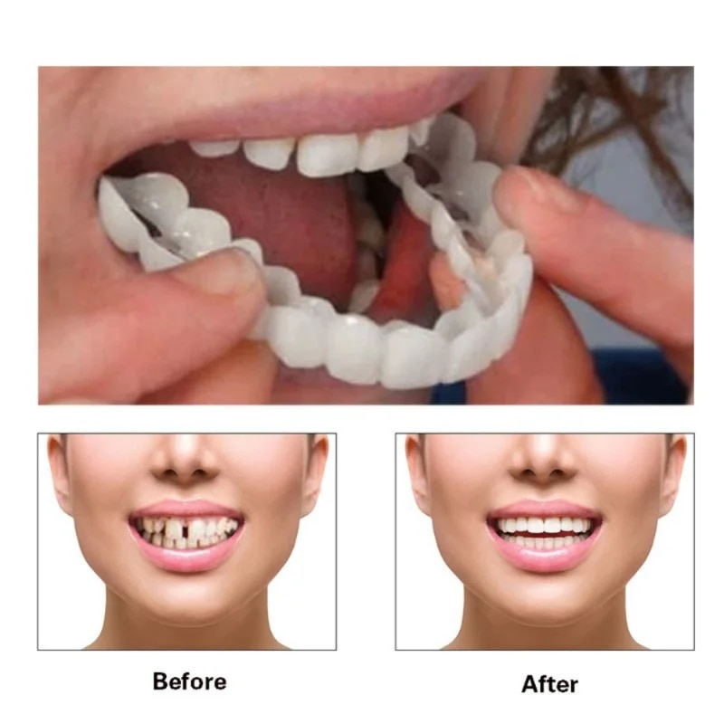 Set regolabile Impiallacciatura sorridente istantanea Sbiancamento denti per protesi Decora gli spazi tra i denti_voghion.com