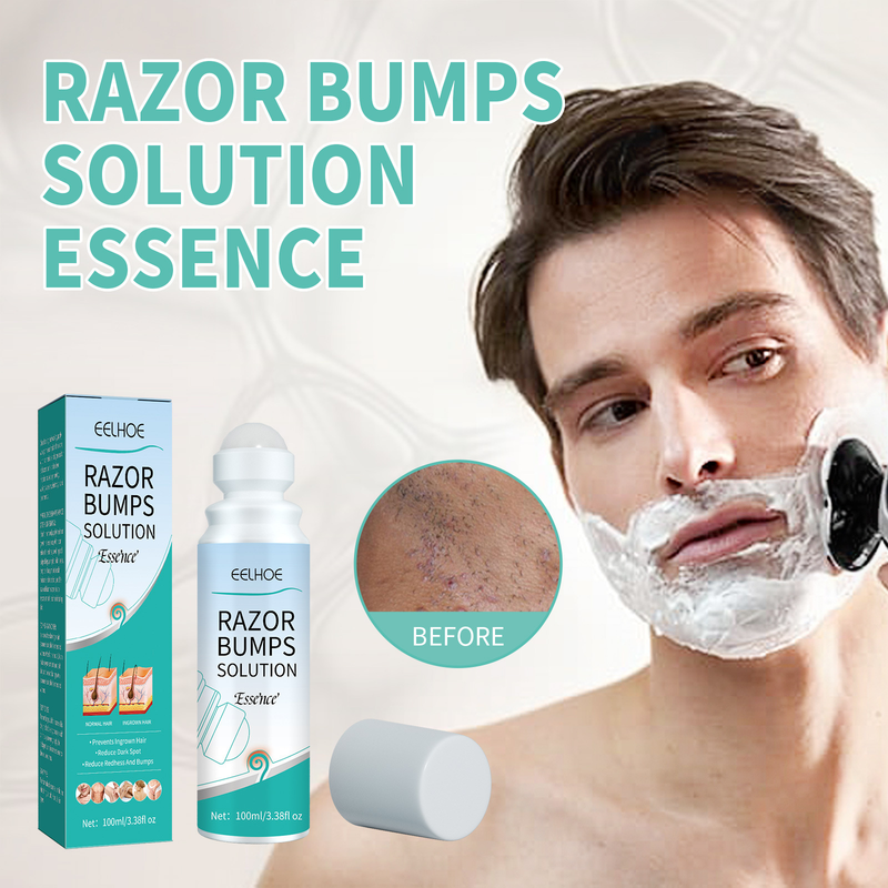 2024 new Shaving lump ball to repair skin pimples and prevent hair from growing inward essence _voghion.com
