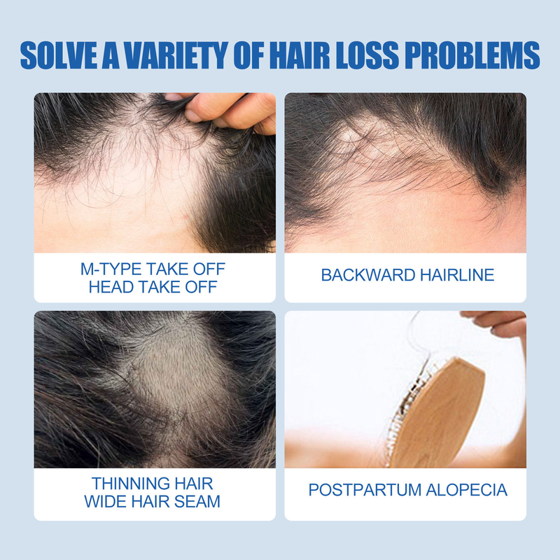 Moon Loss East Prevention Men's Beard Care Concentrate Thick and Firming Hair_voghion.com