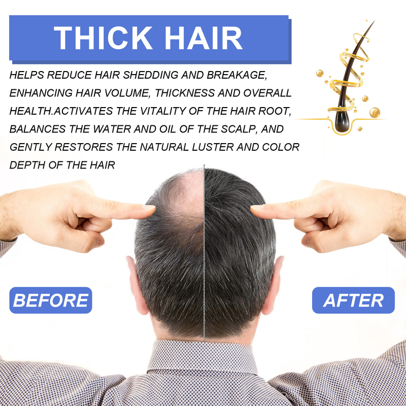 OUHOE-espuma para hombre, limpieza profunda, reparación del folículo de la raíz, cuidado hidratante reafirmante y denso para el cabello_voghion.com