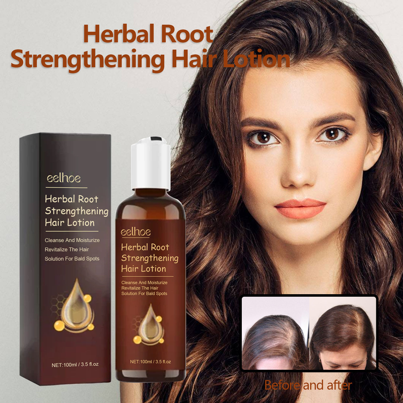 Herbal Root EELHOE lotion Fixing Dense Line Repairing, Tough, Moisturizing, Hair Loss Prevention_voghion.com