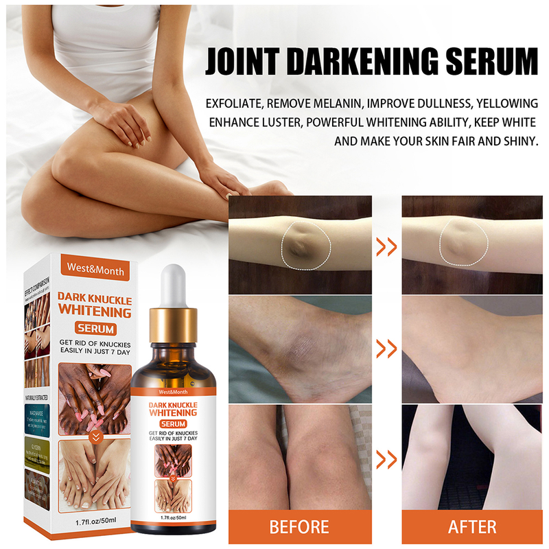50ml Whitening Serum 7 Days Remover Get Rid Of Dark Knees Dark Knuckle Elbow Cream Nicotinamide Brighten Skin Tone 2023 New_voghion.com