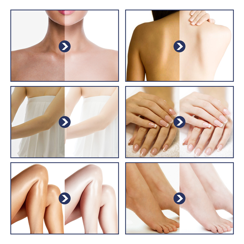 OUHOE Repairs Knee, Finger Joint, Elbow, and Underarm Melanin Moisturizing Skin Whitening Cream_voghion.com
