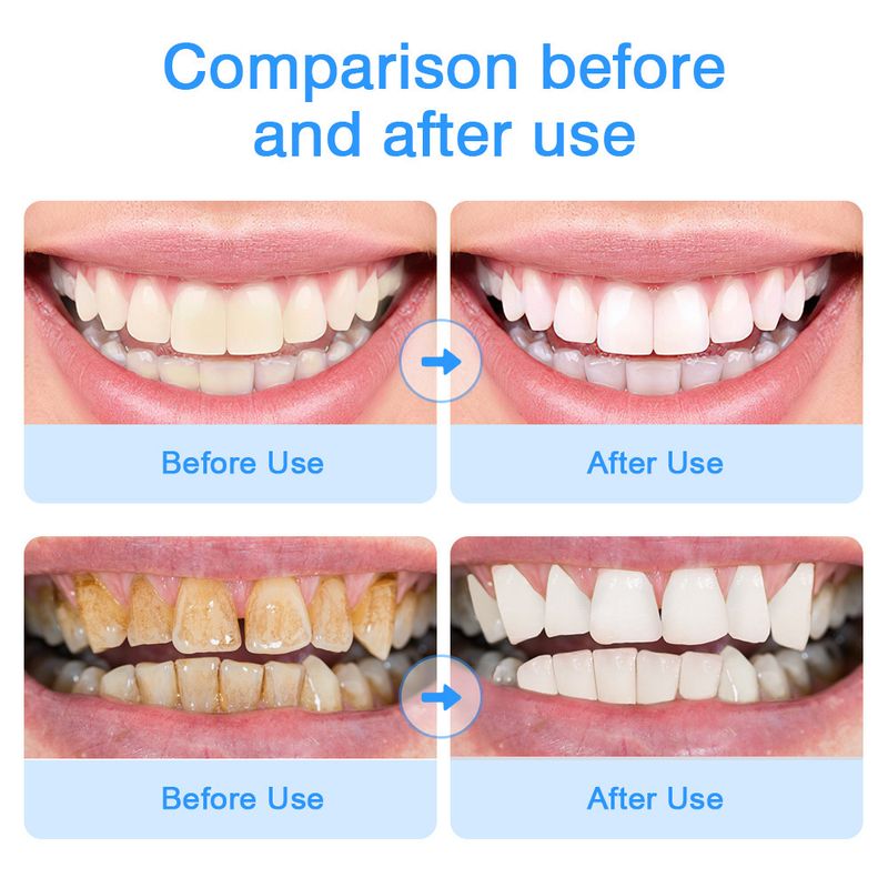 Sonic electric toothbrush soft bristle waterproof charging multi-gear adjustment couple adult toothbrush_voghion.com