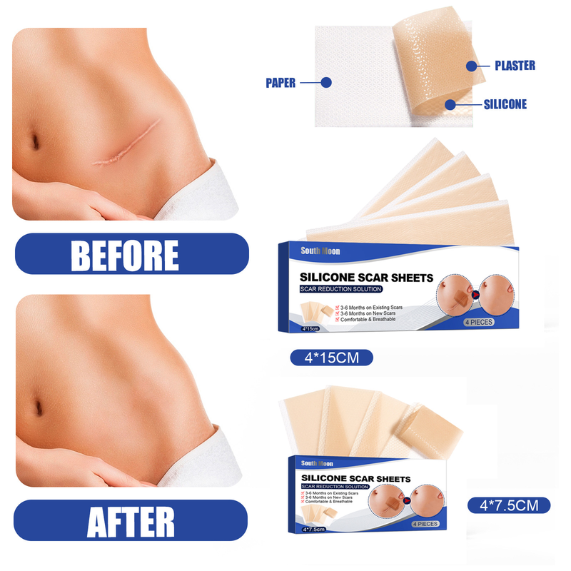 Samolepicí silikonová náplast na jizvy South Moon k opravě popálenin a vyhlazení kožních ran_voghion.com