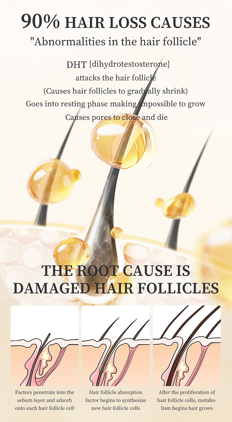Essenza per la crescita dei capelli, soluzione originale nutriente e nutriente per il commercio estero_voghion.com