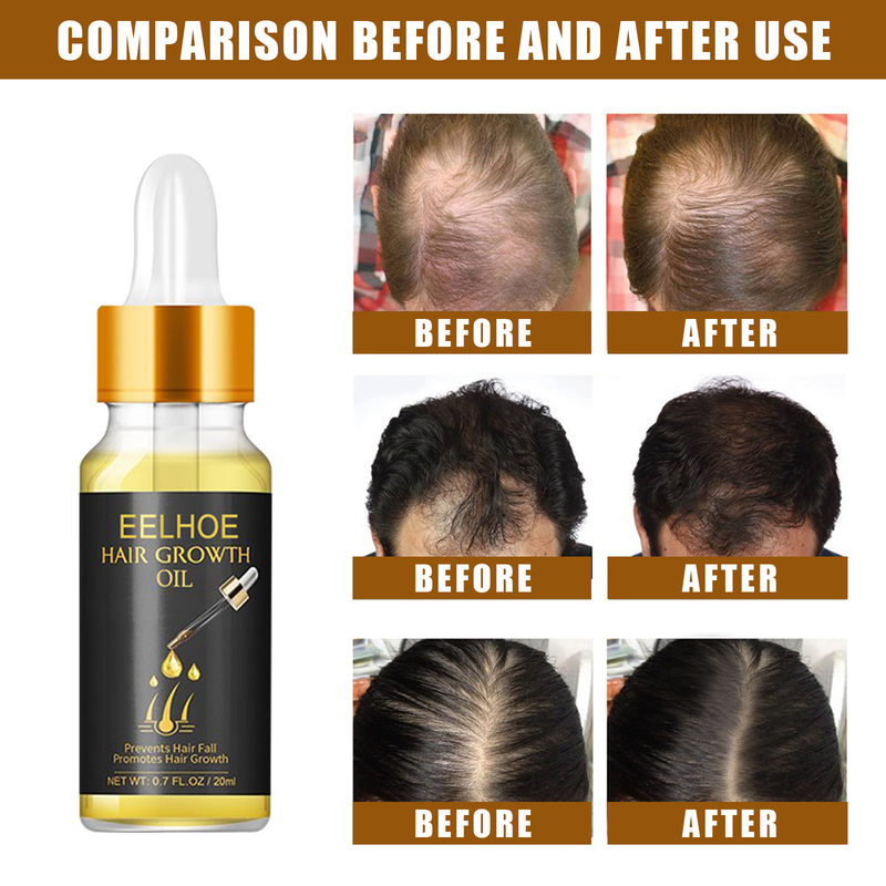Essenz Strong EELHOE Firm Care Ätherisches Öl, weichmachende und feuchtigkeitsspendende Nährflüssigkeit für dichtes Haar_voghion.com