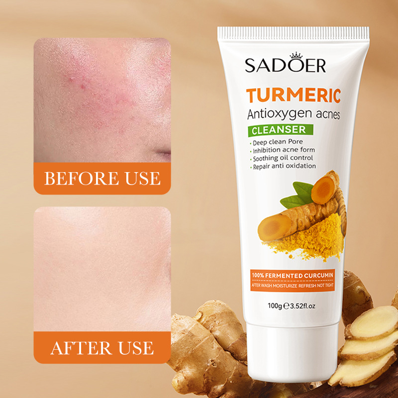 SADOER Turmeric Anti Oxygen Acne Mild Pore Cleansing Milk_voghion.com