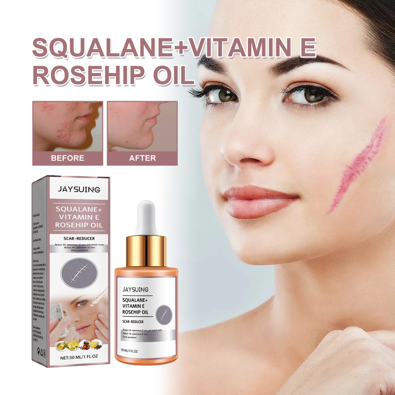 Jaysuing Squalane+Vitamin E Rose Fruit Oil to Desalinate Cesarean Section Surgery Scar and Remove Burn Marks_voghion.com