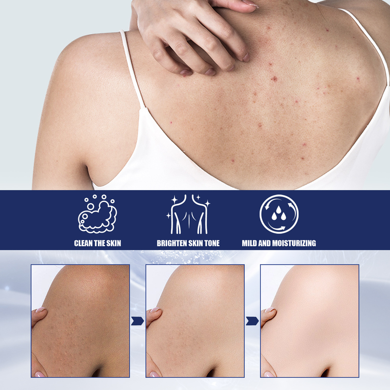 body scrub for deep cleansing care, gentle exfoliation, dead rejuvenation, and whitening of the skin_voghion.com