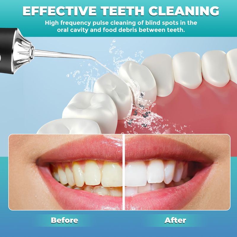 Irrigatore orale portatile senza fili, irrigatore dentale portatile, filo interdentale ricaricabile, pulisci denti_voghion.com
