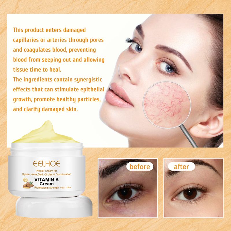EELHOE Vitamin K Cream Περιποίηση δέρματος για πονεμένα και πρησμένα πόδια Κρέμα μασάζ για φλέβες ποδιών με γαιοσκώληκες_voghion.com