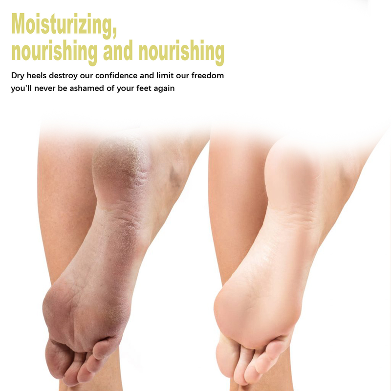 Care Beautiful fotspray fotvårdsvätska återfuktande deodorantspray exfolierande, peeling och motverkar sprickor_voghion.com