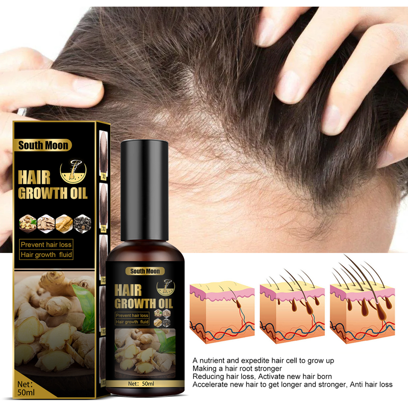 South Moon fertilitet spray anti förlust lotion hår näring tillväxt agent essens_voghion.com