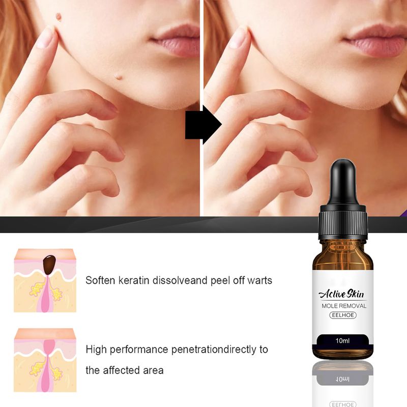 10 ml Behandlung zur Hühneraugenentfernung, tiefes Eindringen, gesunde, multifunktionale Essenz zur Entfernung von Hautmalen für Mädchen_voghion.com